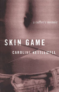 Title: Skin Game: A Memoir, Author: Caroline Kettlewell