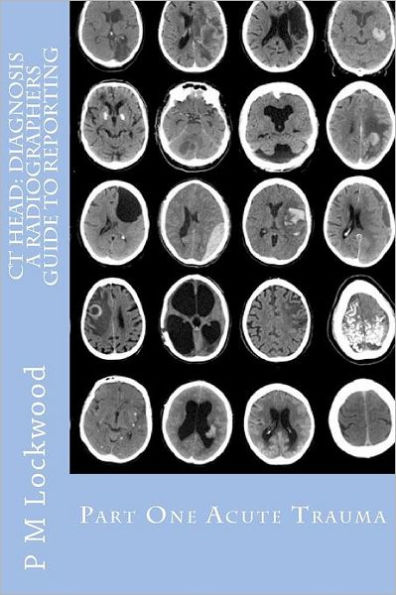 CT Head: DIAGNOSIS A Radiographers Guide To Reporting Part 1 Acute Trauma: Part One Acute Trauma