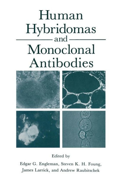 Human Hybridomas and Monoclonal Antibodies