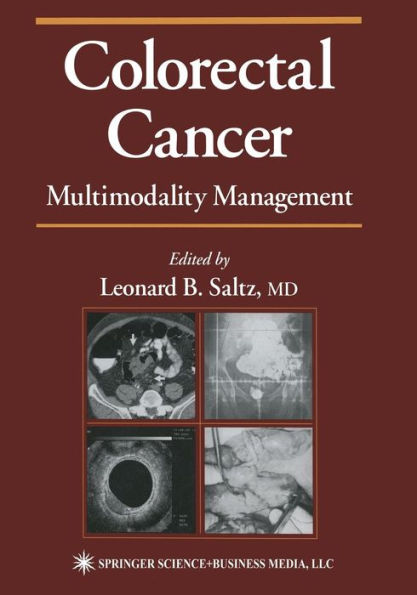 Colorectal Cancer: Multimodality Management