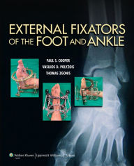 Title: External Fixators of the Foot and Ankle, Author: Paul Cooper