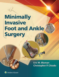 Title: Minimally Invasive Foot & Ankle Surgery, Author: Eric Bluman