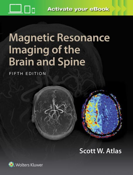Magnetic Resonance Imaging of the Brain and Spine / Edition 5
