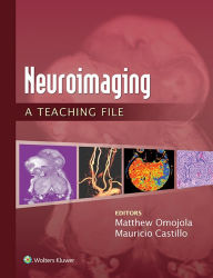 Title: Neuroimaging: A Teaching File: A Teaching File, Author: Matthew Omojola
