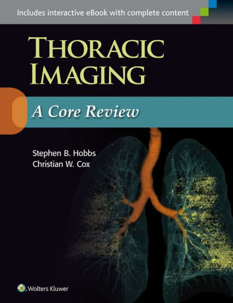 Thoracic Radiology: A Core Review