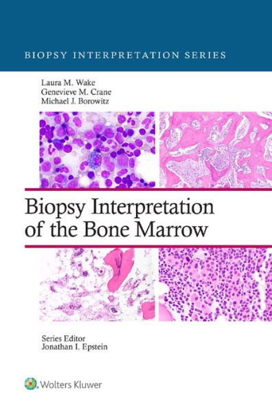 Biopsy Interpretation of the Bone Marrow