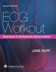 Title: ECG Workout: Exercises in Arrhythmia Interpretation, Author: Jane Huff