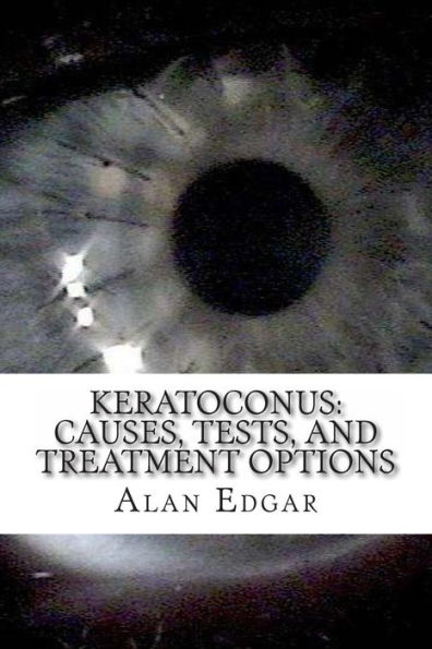 Keratoconus: Causes, Tests, and Treatment Options