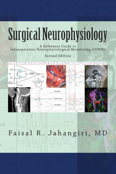 Surgical Neurophysiology - 2nd Edition: A Reference Guide to Intraoperative Neurophysiological Monitoring / Edition 2