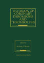 Textbook of Coronary Thrombosis and Thrombolysis