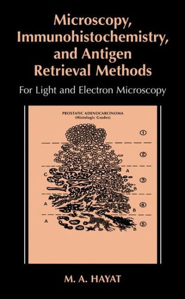 Microscopy, Immunohistochemistry, and Antigen Retrieval Methods: For Light and Electron Microscopy