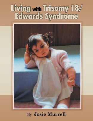 Living With Trisomy 18 / Edwards Syndrome By Josie Murrell, Paperback ...