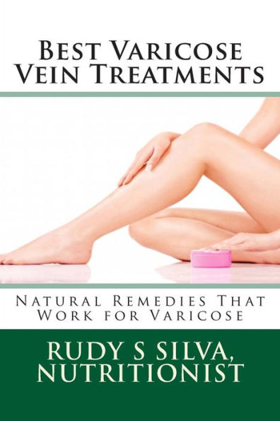 Best Varicose Vein Treatments: Natural Remedies That Work For