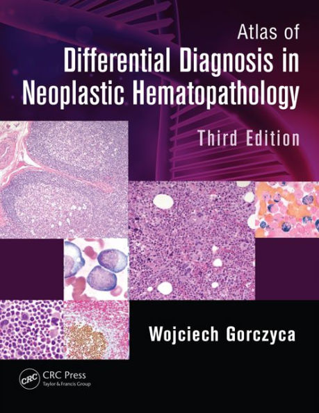 Atlas of Differential Diagnosis in Neoplastic Hematopathology / Edition 3