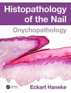 Histopathology of the Nail: Onychopathology / Edition 1