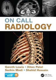 Title: On Call Radiology / Edition 1, Author: Gareth Lewis