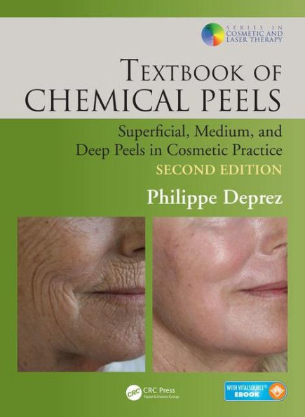 Textbook of Chemical Peels: Superficial, Medium, and Deep Peels in Cosmetic Practice