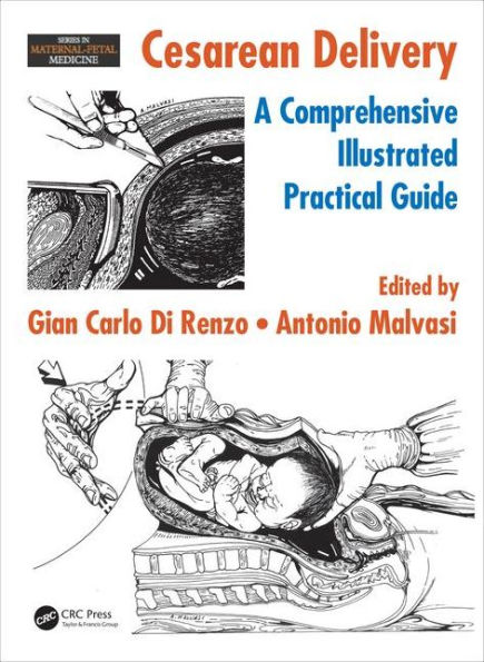 Cesarean Delivery: A Comprehensive Illustrated Practical Guide / Edition 1