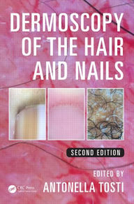 Title: Dermoscopy of the Hair and Nails / Edition 2, Author: Antonella Tosti