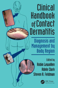 Title: Clinical Handbook of Contact Dermatitis: Diagnosis and Management by Body Region / Edition 1, Author: Robin Lewallen