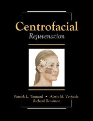 Pda ebook download Centrofacial Rejuvenation in English RTF