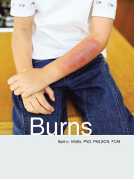 Title: Burns, Author: Ikpe O. Vitalis PhD FMLSCN FCAI