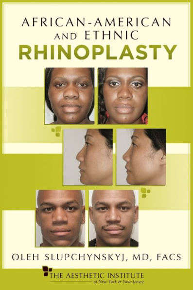 African-American and Ethnic Rhinoplasty