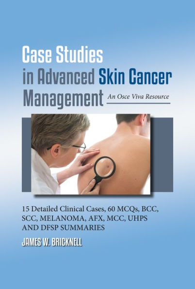 Case Studies in Advanced Skin Cancer Management: An Osce Viva Resource