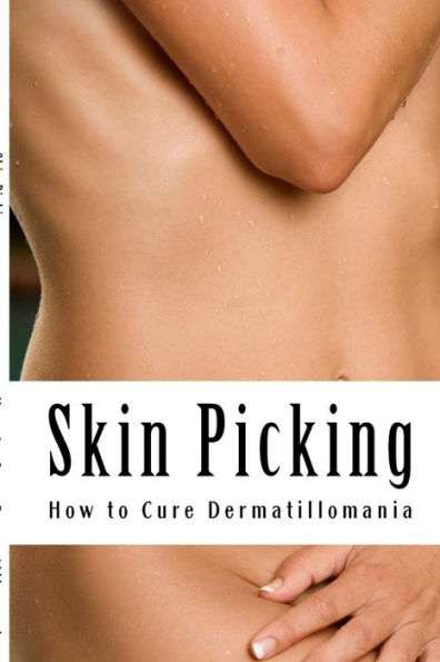 Skin Picking: How to Cure Dermatillomania
