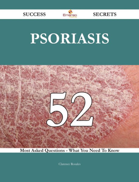 Psoriasis 52 Success Secrets - 52 Most Asked Questions On Psoriasis - What You Need To Know