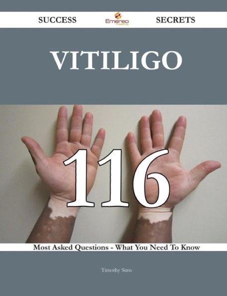 Vitiligo 116 Success Secrets - Most Asked Questions On What You Need To Know