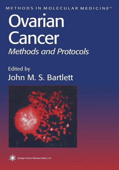 Ovarian Cancer: Methods and Protocols