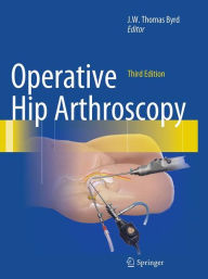 Title: Operative Hip Arthroscopy / Edition 3, Author: J.W. Thomas Byrd