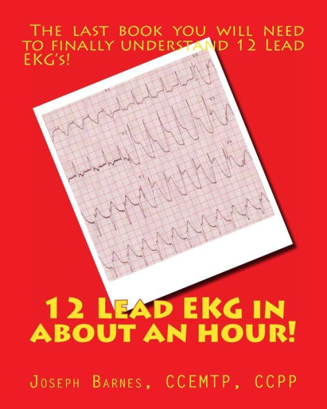 12 Lead EKG in about an Hour!