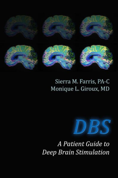 DBS a Patient Guide to Deep Brain Stimulation