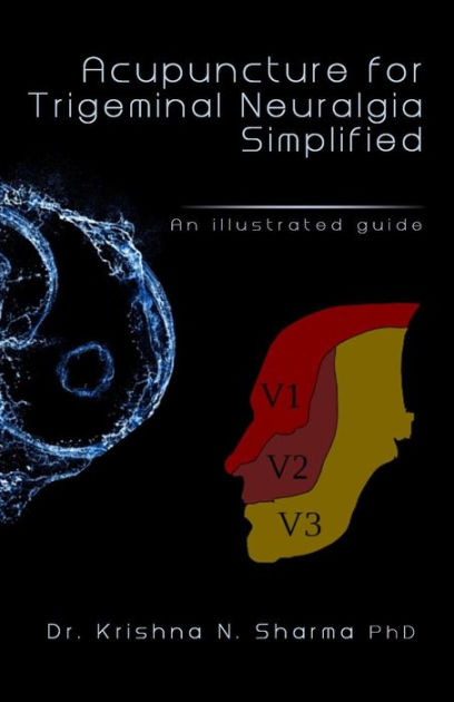 Acupuncture for Trigeminal Neuralgia Simplified: An Illustrated Guide ...