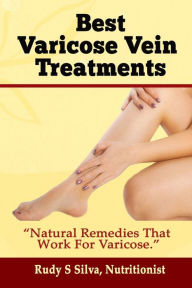 Title: Best Varicose Vein Treatments: Natural Remedies That Work for Varicose, Author: Rudy Silva Silva