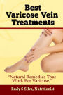 Best Varicose Vein Treatments: Natural Remedies That Work for Varicose