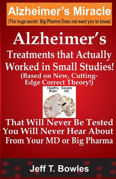 Alzheimer's Treatments That Actually Worked In Small Studies! (Based On New, Cutting-Edge, Correct Theory!) That Will Never Be Tested & You Will Never Hear About From Your MD Or Big Pharma !