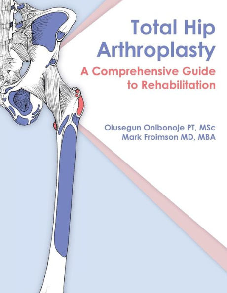 Total Hip Arthroplasty: A Comprehensive Guide to Rehabilitation