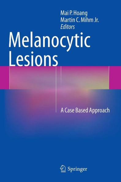 Melanocytic Lesions: A Case Based Approach