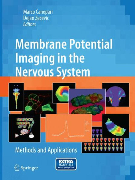 Membrane Potential Imaging in the Nervous System: Methods and Applications