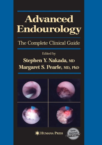 Advanced Endourology: The Complete Clinical Guide