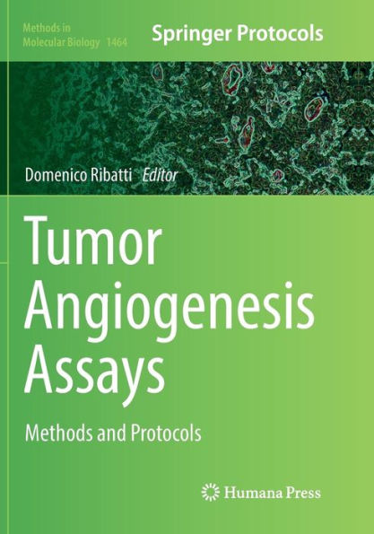 Tumor Angiogenesis Assays: Methods and Protocols