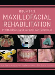 Title: Beumer's Maxillofacial Rehabilitation: Prosthodontics and Surgical Considerations, Author: Arun Sharma