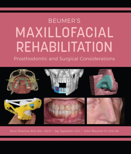 Beumer's Maxillofacial Rehabilitation: Prosthodontics and Surgical Considerations