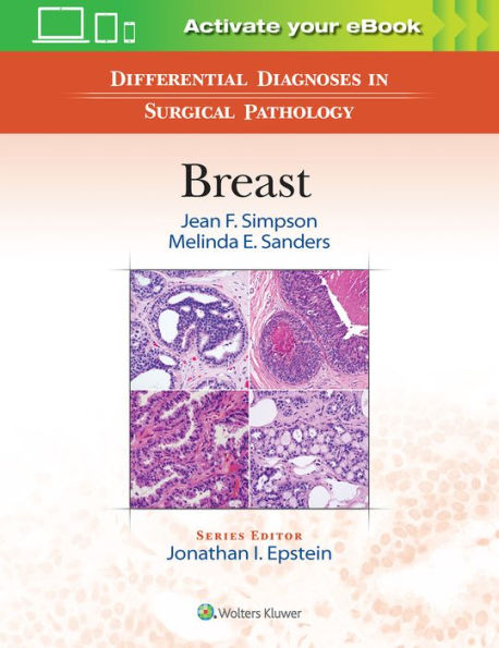 Differential Diagnoses in Surgical Pathology: Breast / Edition 1