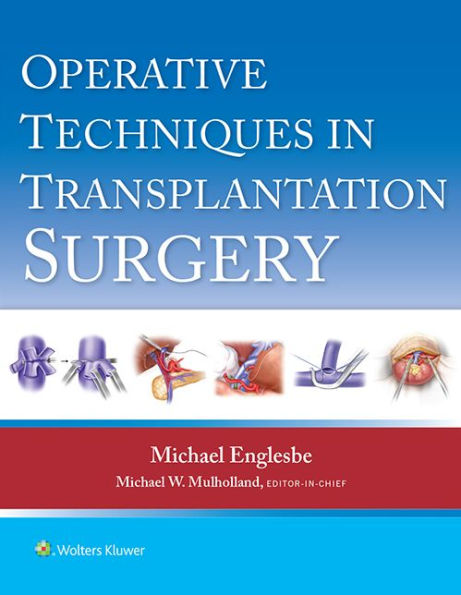 Operative Techniques in Transplantation Surgery