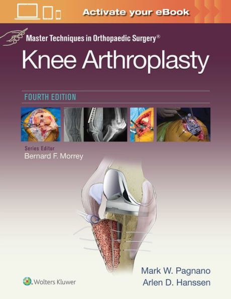 Master Techniques in Orthopedic Surgery: Knee Arthroplasty / Edition 4