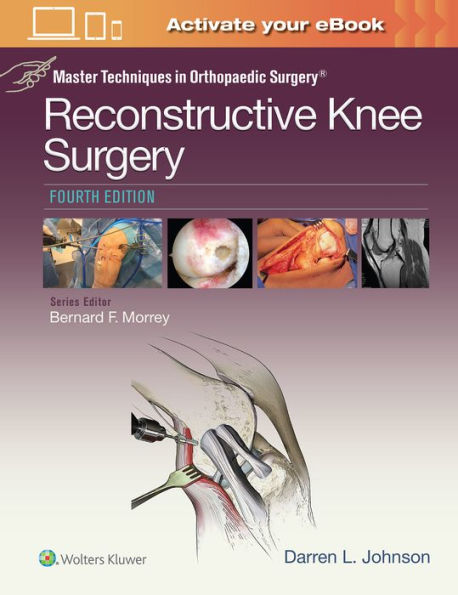 Master Techniques in Orthopaedic Surgery: Reconstructive Knee Surgery / Edition 4